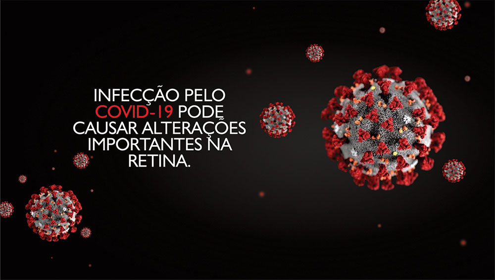 INFECÇÃO PELO COVID-19 PODE CAUSAR ALTERAÇÕES IMPORTANTES NA RETINA.
