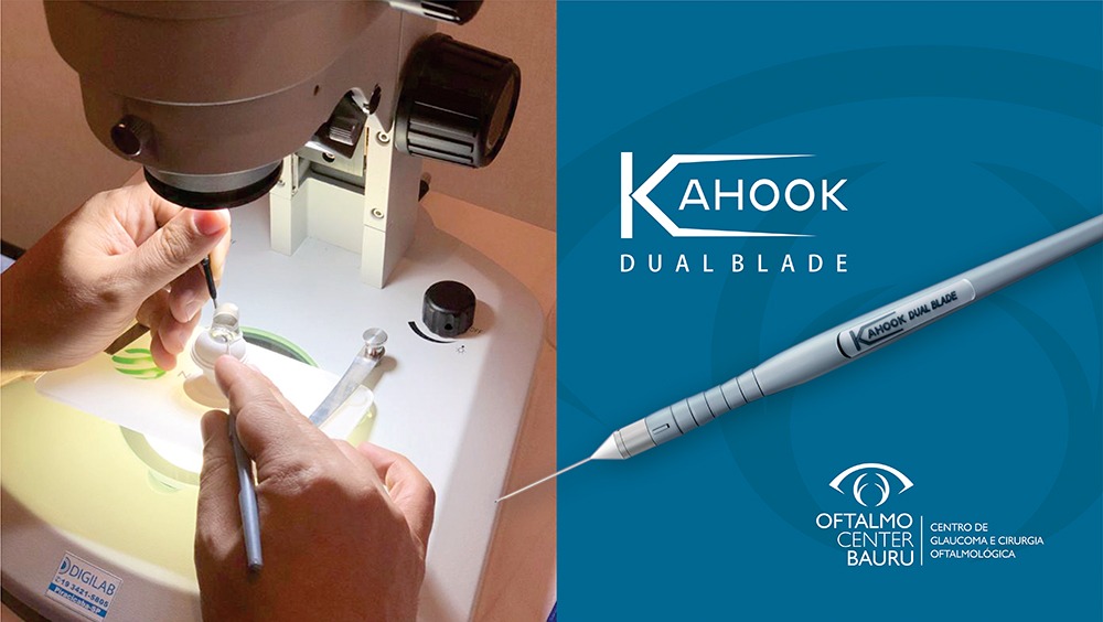O que há de novo no tratamento cirúrgico do glaucoma? Trabeculotomia com Kahook Dual Blade (KDB)